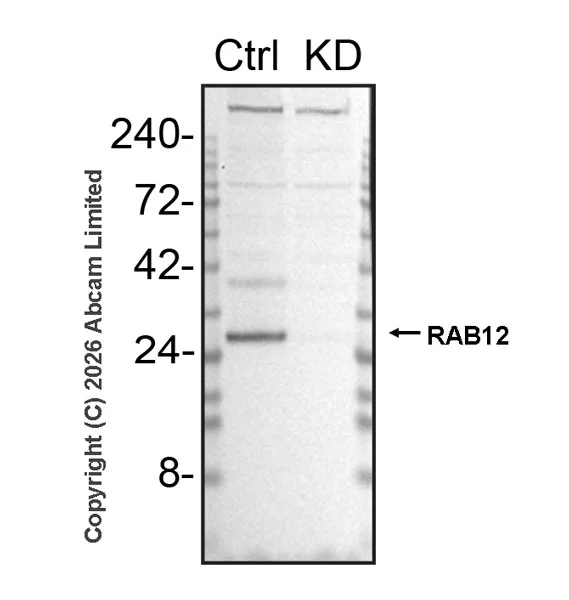Western blot - Anti-RAB12 antibody [MJF-D28814-65R] (AB325799)