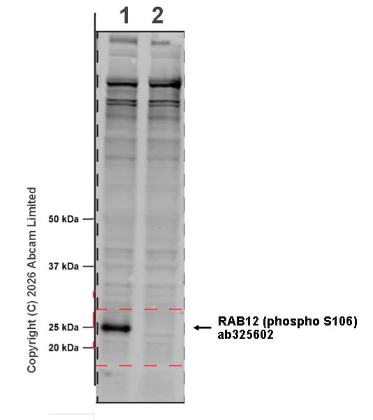 Western blot - Anti-RAB12 (phospho S106) antibody [MJF-D29764-507] (AB325602)
