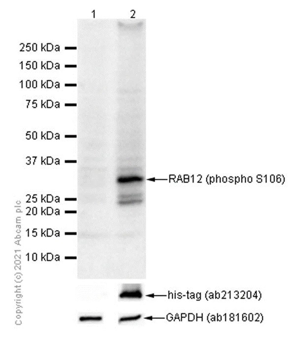 Western blot - Anti-RAB12 (phospho S106) antibody [MJF-R25-9] (AB256487)