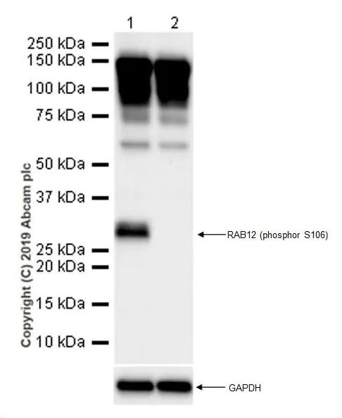 Anti-RAB12 (phospho S106) antibody [MJF-R25-9] - BSA and Azide free