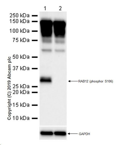 Western blot - Anti-RAB12 (phospho S106) antibody [MJF-R25-9] - BSA and Azide free (AB256765)