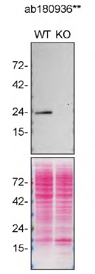 Anti-RAB13 antibody [EPR14109(B)]