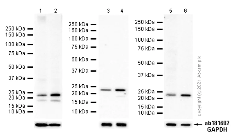 Western blot - Anti-RAB13 antibody [EPR14109(B)] - BSA and Azide free (AB250269)