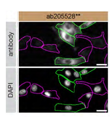 Immunocytochemistry/ Immunofluorescence - Anti-RAB13 antibody [EPR14110(2)] (AB205528)