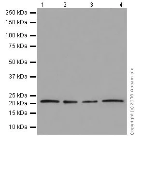 Western blot - Anti-RAB13 antibody [EPR14110(2)] - BSA and Azide free (AB251431)