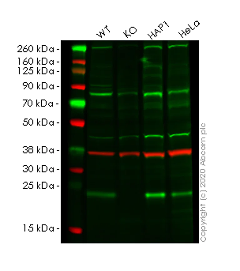 Western blot - Anti-RAB13 antibody [EPR14110(2)] - BSA and Azide free (AB251431)