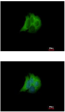 Immunocytochemistry/ Immunofluorescence - Anti-Rab17 antibody (AB155135), expandable thumbnail
