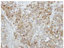 Immunohistochemistry (Formalin/PFA-fixed paraffin-embedded sections) - Anti-Rab17 antibody (AB155135), expandable thumbnail