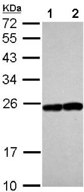 Western blot - Anti-Rab17 antibody (AB155135), expandable thumbnail