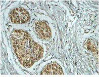 Immunohistochemistry (Formalin/PFA-fixed paraffin-embedded sections) - Anti-Rab18 antibody (AB119900)