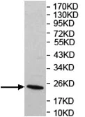 Western blot - Anti-Rab18 antibody (AB119900)