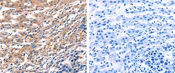 Immunohistochemistry (Formalin/PFA-fixed paraffin-embedded sections) - Anti-Rab18 antibody (AB182764), expandable thumbnail