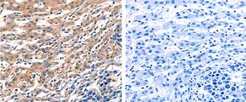Immunohistochemistry (Formalin/PFA-fixed paraffin-embedded sections) - Anti-Rab18 antibody (AB182764)