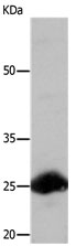 Western blot - Anti-Rab18 antibody (AB182764), expandable thumbnail