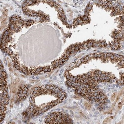 Immunohistochemistry (Formalin/PFA-fixed paraffin-embedded sections) - Anti-Rab18 antibody (AB224466)