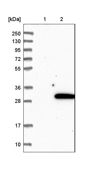 Western blot - Anti-Rab18 antibody (AB224466)