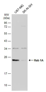 Western blot - Anti-Rab1A antibody (AB228354)