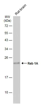 Western blot - Anti-Rab1A antibody (AB228354)