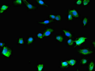 Immunocytochemistry/ Immunofluorescence - Anti-RAB1B antibody (AB234717), expandable thumbnail