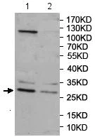 Western blot - Anti-Rab20 antibody (AB197209)