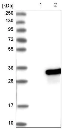 Western blot - Anti-RAB21 antibody (AB224390)