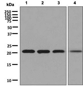Western blot - Anti-RAB22A antibody [EPR9486] (AB137093), expandable thumbnail