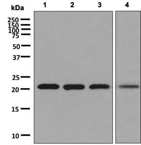 Western blot - Anti-RAB22A antibody [EPR9486] (AB137093)