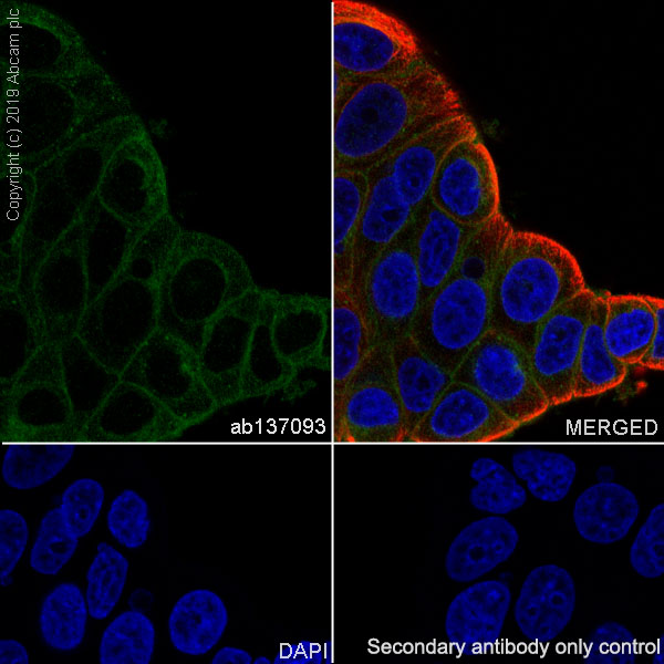 Immunocytochemistry/ Immunofluorescence - Anti-RAB22A antibody [EPR9486] - BSA and Azide free (AB240105), expandable thumbnail
