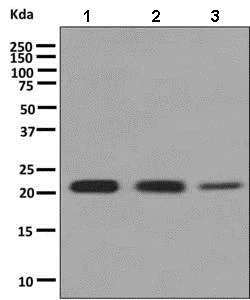 Western blot - Anti-RAB22A antibody [EPR9487] - BSA and Azide free (AB248852)