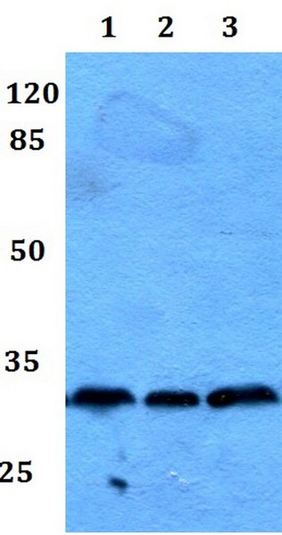 Western blot - Anti-RAB23 antibody (AB192420), expandable thumbnail