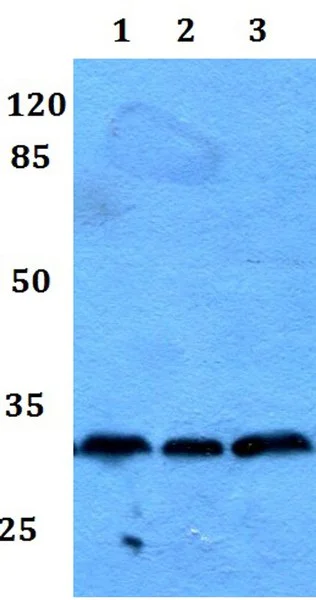 Western blot - Anti-RAB23 antibody (AB192420)
