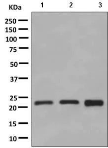 Western blot - Anti-Rab24 antibody [EPR9131] (AB154824)