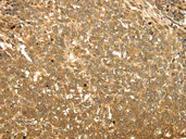 Immunohistochemistry (Formalin/PFA-fixed paraffin-embedded sections) - Anti-RAB26 antibody (AB198202)