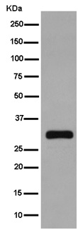 Western blot - Anti-RAB26 antibody [EPR15975(B)] - C-terminal (AB187151)