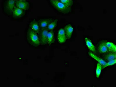 Immunocytochemistry/ Immunofluorescence - Anti-RAB27A antibody (AB223044)