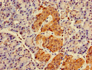 Immunohistochemistry (Formalin/PFA-fixed paraffin-embedded sections) - Anti-RAB27A antibody (AB223044)