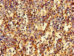 Immunohistochemistry (Formalin/PFA-fixed paraffin-embedded sections) - Anti-RAB27A antibody (AB223044)