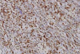 Immunohistochemistry (Formalin/PFA-fixed paraffin-embedded sections) - Anti-RAB27A + RAB27B antibody [1G7] (ab55667), expandable thumbnail