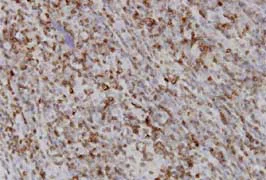 Immunohistochemistry (Formalin/PFA-fixed paraffin-embedded sections) - Anti-RAB27A + RAB27B antibody [1G7] (AB55667)