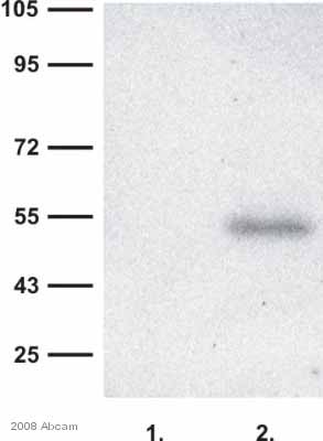 Western blot - Anti-RAB27A + RAB27B antibody [1G7] (AB55667), expandable thumbnail