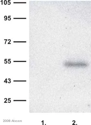 Western blot - Anti-RAB27A + RAB27B antibody [1G7] (AB55667)