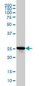 Western blot - Anti-RAB27A + RAB27B antibody [1G7] (AB55667), expandable thumbnail