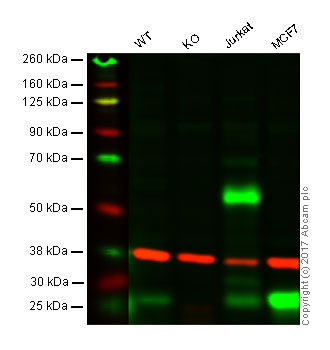 Western blot - Anti-RAB27A + RAB27B antibody [1G7] (AB55667), expandable thumbnail