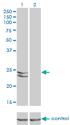 Western blot - Anti-RAB27A + RAB27B antibody [1G7] (AB55667), expandable thumbnail