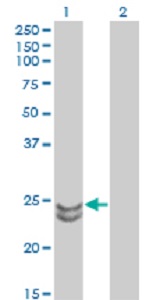 Western blot - Anti-RAB27A + RAB27B antibody [1G7] (AB55667), expandable thumbnail