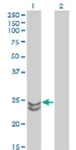 Western blot - Anti-RAB27A + RAB27B antibody [1G7] (AB55667)