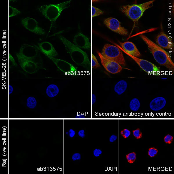 Immunocytochemistry/ Immunofluorescence - Anti-RAB27A + RAB27B antibody [EPR27120-68] (AB313575)