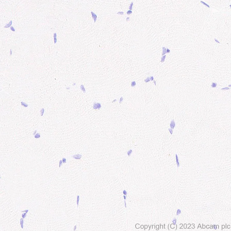 Immunohistochemistry (Formalin/PFA-fixed paraffin-embedded sections) - Anti-RAB27A + RAB27B antibody [EPR27120-68] (AB313575)