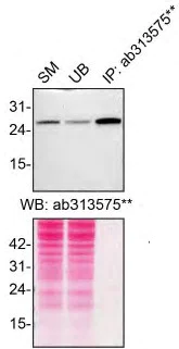 Immunoprecipitation - Anti-RAB27A + RAB27B antibody [EPR27120-68] (AB313575)