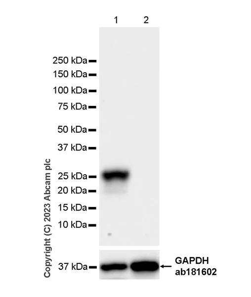 Western blot - Anti-RAB27A + RAB27B antibody [EPR27120-68] (AB313575)